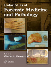 Color Atlas of Forensic Medicine and Pathology, DVD