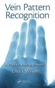 Vein Pattern Recognition