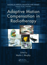 Adaptive Motion Compensation in Radiotherapy