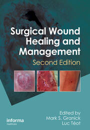 Surgical Wound Healing and Management, Second Edition