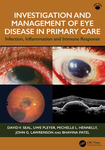 Investigation & Management of Eye Disease in Primary Care - book cover