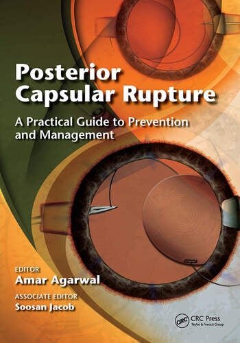 Posterior Capsular Rupture - book cover
